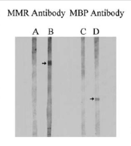 2002 abnormal measles mumps rubella antibodies CNS autoimmunity in children with autism 2